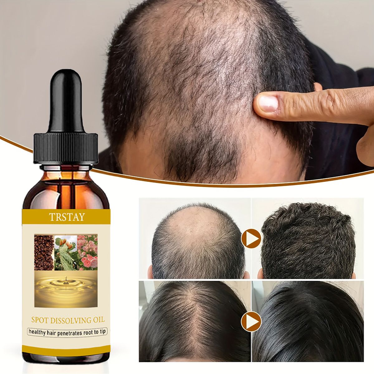 50 مللي نمو اللحية النفط مكافح - مراجعة Beard Oil وسعره